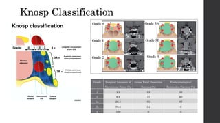 TSS .pptxTSSTSS Transnasal endoscopic surgery | PPTX