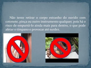Não tente retirar o corpo estranho do ouvido com
cotonete, pinça ou outro instrumento qualquer, pois há o
risco de empurrá-lo ainda mais para dentro, o que pode
afetar o tímpano e provocar até surdez.
 