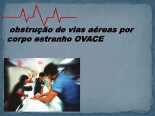 obstrução de vias aéreas por
corpo estranho OVACE
 