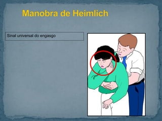 Sinal universal do engasgo
 