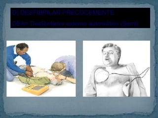 D) DESFIBRILAR PRECOCEMENTE
DEA= Desfibrilador externo automático (Semi)
 