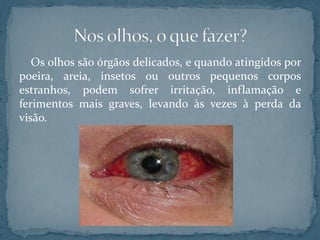Os olhos são órgãos delicados, e quando atingidos por
poeira, areia, insetos ou outros pequenos corpos
estranhos, podem sofrer irritação, inflamação e
ferimentos mais graves, levando às vezes à perda da
visão.
 