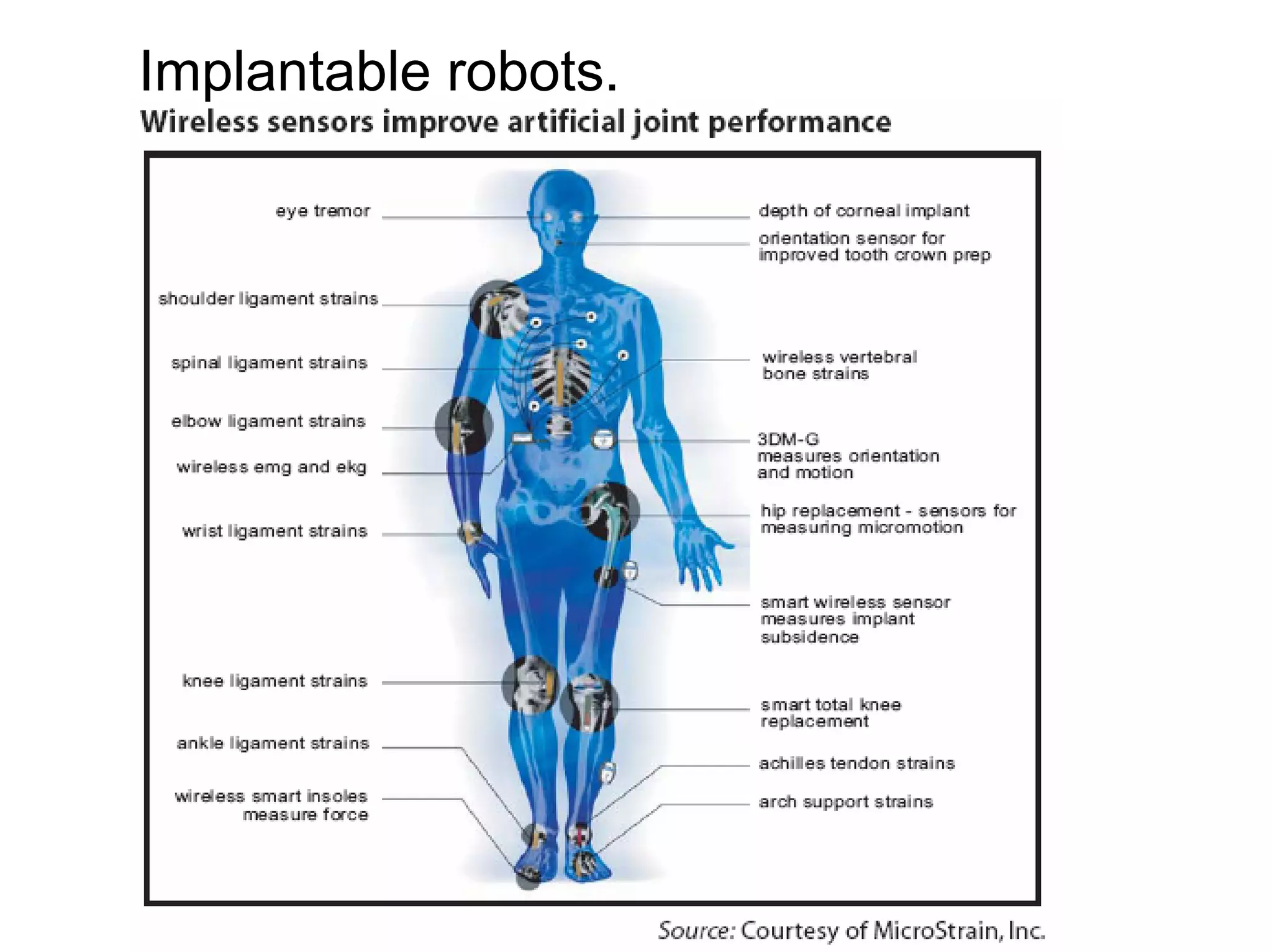 Implantable robots.
 
