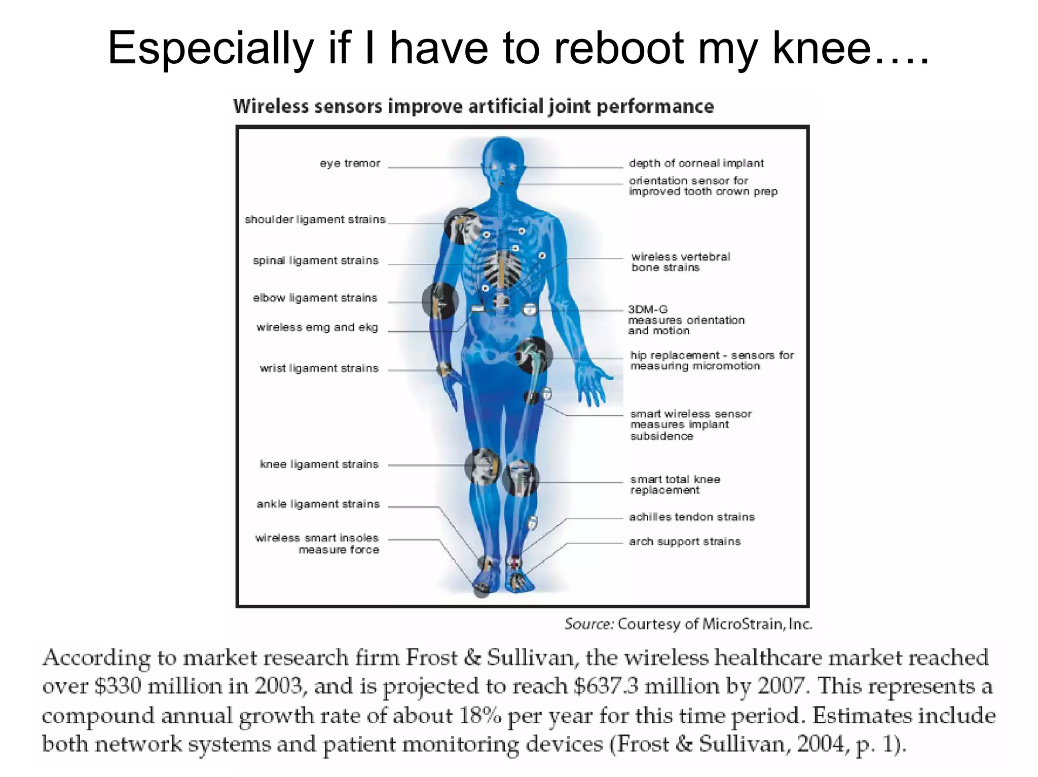 Especially if I have to reboot my knee….
 