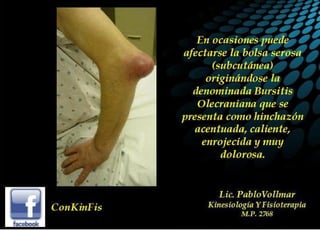 Tendinitis del Triceps