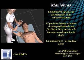 Tendinitis del Triceps