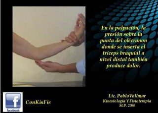 Tendinitis del Triceps