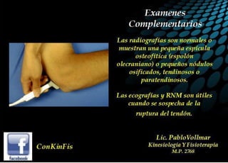 Tendinitis del Triceps