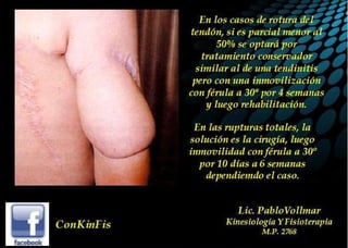 Tendinitis del Triceps