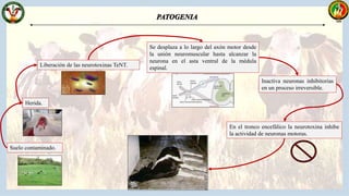 Suelo contaminado.
Herida.
Liberación de las neurotoxinas TeNT.
Se desplaza a lo largo del axón motor desde
la unión neuromuscular hasta alcanzar la
neurona en el asta ventral de la médula
espinal.
Inactiva neuronas inhibitorias
en un proceso irreversible.
En el tronco encefálico la neurotoxina inhibe
la actividad de neuronas motoras.
 