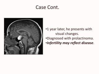 Case Cont.
•1 year later, he presents with
visual changes.
•Diagnosed with prolactinoma.
•Infertility may reflect disease.
 