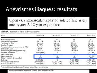 Anévrismes iliaques: résultats
 