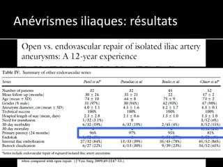 Anévrismes iliaques: résultats
 