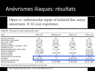 Anévrismes iliaques: résultats
 