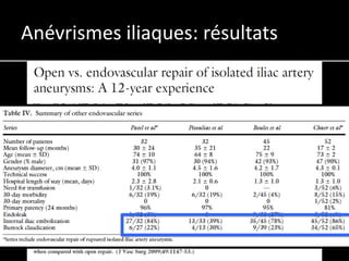 Anévrismes iliaques: résultats
 