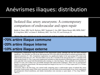 Anévrismes iliaques: distribution



•70% artère iliaque commune
•20% artère iliaque interne
•10% artère iliaque externe
 