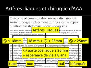 Artères iliaques et chirurgie d’AAA


                Artères iliaques

 ≤ 18mm      18 mm <  < 25mm            ≥ 25mm

            aorte coeliaque ≥ 26mm
           + espérance de vie ≥ 8 ans

  tube       non                   oui   bifurquée
 