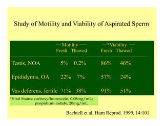 Study of Motility and Viability of Aspirated Sperm
Bachtell et al. Hum Reprod. 1999, 14:101
Motility *Viability
Fresh Thawed Fresh Thawed
Testis, NOA 5% 0.2% 86% 46%
Epididymis, OA 22% 7% 57% 24%
Vas deferens, fertile 71% 38% 91% 51%
*Vital Stains: carboxyfluorescein, 0.08mg/mL;
propidium iodide, 20mg/mL
 