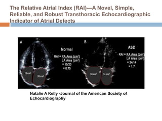 The Relative Atrial Index (RAI)—A Novel, Simple,
Reliable, and Robust Transthoracic Echocardiographic
Indicator of Atrial Defects
Natalie A Kelly -Journal of the American Society of
Echocardiography
 