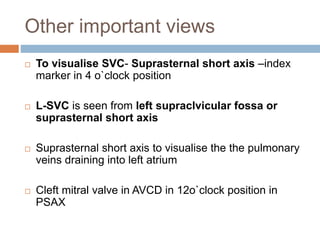 Other important views
 To visualise SVC- Suprasternal short axis –index
marker in 4 o`clock position
 L-SVC is seen from left supraclvicular fossa or
suprasternal short axis
 Suprasternal short axis to visualise the the pulmonary
veins draining into left atrium
 Cleft mitral valve in AVCD in 12o`clock position in
PSAX
 