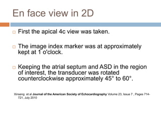 En face view in 2D
 First the apical 4c view was taken.
 The image index marker was at approximately
kept at 1 o'clock.
 Keeping the atrial septum and ASD in the region
of interest, the transducer was rotated
counterclockwise approximately 45° to 60°.
Xinseng et al Journal of the American Society of Echocardiography Volume 23, Issue 7 , Pages 714-
721, July 2010
 