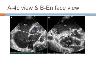 A-4c view & B-En face view
 