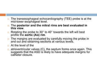  The transesophageal echocardiography (TEE) probe is at the
mid-lower esophageal level.
 The posterior and the mitral rims are best evaluated in
this view.
 Rotating the probe to 30° to 40° towards the left will best
profile the aortic (Ao) rim.
 The margins are evaluated by carefully moving the probe in
and out and obtaining sections at various levels.
 At the level of the
 atrioventricular valves (C), the septum forms once again. This
suggests that the ASD is likely to have adequate margins for
catheter closure.
 