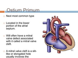 Ostium Primum
 Next most common type
 Located in the lower
portion of the atrial
septum.
 Will often have a mitral
valve defect associated
with it called a mitral valve
cleft.
 A mitral valve cleft is a slit-
like or elongated hole
usually involves the
 