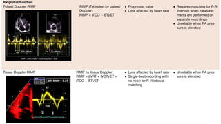 Cardiac Chamber quantification by echocardiography.pptx
