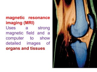 magnetic resonance
imaging (MRI)
Uses a strong
magnetic field and a
computer to show
detailed images of
organs and tissues