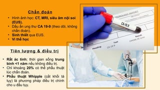 Chẩn đoán
• Hình ảnh học: CT, MRI, siêu âm nội soi
(EUS).
• Dấu ấn ung thư CA 19-9 (theo dõi, không
chẩn đoán).
• Sinh thiết qua EUS.
• Vi thể học
Tiên lượng & điều trị
• Rất ác tính; thời gian sống trung
bình <1 năm nếu không điều trị.
• Chỉ khoảng 20% có thể phẫu thuật
lúc chẩn đoán.
• Phẫu thuật Whipple (cắt khối tá
tụy) là phương pháp điều trị chính
cho u đầu tụy.
 