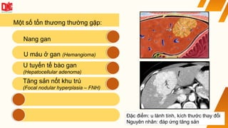 Một số tổn thương thường gặp:
Tăng sản nốt khu trú
(Focal nodular hyperplasia – FNH)
U máu ở gan (Hemangioma)
U tuyến tế bào gan
(Hepatocellular adenoma)
Nang gan
Đặc điểm: u lành tính, kích thước thay đổi
Nguyên nhân: đáp ứng tăng sản
 