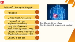Một số tổn thương thường gặp:
Tăng sản nốt khu trú
(Focal nodular hyperplasia – FNH)
U máu ở gan (Hemangioma)
U tuyến tế bào gan
(Hepatocellular adenoma)
Nang gan
Ung thư biểu mô tế bào gan
(Hepatocellular carcinoma – HCC)
Ung thư di căn gan
Đặc điểm: xâm lấn nhu mô gan
Nguyên nhân: khối u nguyên phát ngoài gan
 