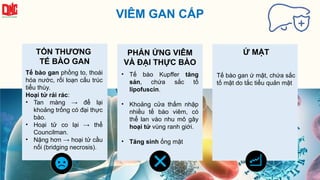 VIÊM GAN CẤP
TỔN THƯƠNG
TẾ BÀO GAN
Tế bào gan phồng to, thoái
hóa nước, rối loạn cấu trúc
tiểu thùy.
Hoại tử rải rác:
• Tan màng → để lại
khoảng trống có đại thực
bào.
• Hoại tử co lại → thể
Councilman.
• Nặng hơn → hoại tử cầu
nối (bridging necrosis).
PHẢN ỨNG VIÊM
VÀ ĐẠI THỰC BÀO
• Tế bào Kupffer tăng
sản, chứa sắc tố
lipofuscin.
• Khoảng cửa thấm nhập
nhiều tế bào viêm, có
thể lan vào nhu mô gây
hoại tử vùng ranh giới.
• Tăng sinh ống mật
Ứ MẬT
Tế bào gan ứ mật, chứa sắc
tố mật do tắc tiểu quản mật
 