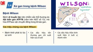 Xơ gan trong bệnh Wilson
3.4
Bệnh di truyền lặn trên nhiễm sắc thể thường do
đột biến gen ATP7B (nằm trên NST số 13), mã
hóa ATPase vận chuyển đồng trong tế bào gan.
Các triệu chứng của bệnh Wilson:
Bệnh Wilson
• Bệnh khởi phát từ lúc
sơ sinh
• Các dấu hiệu tổn
thương gan chỉ xuất
hiện sau 6 tuổi
• Các dấu hiệu thần kinh
xuất hiện ở tuổi vị
thành niên
 