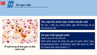 Xơ gan mật nguyên phát
Gặp ở phụ nữ 40–59 tuổi
Khởi phát ngứa rồi vàng da; gan to xanh mềm; tăng
phosphatase kiềm, cholesterol, lipid; liên quan tự miễn
(tự kháng thể, tăng lympho T).
Tắc mật thứ phát hoặc nhiễm khuẩn mật
Do sỏi, u đầu tụy, bóng Vater; gây tổn thương và xơ
hóa đường mật.
Xơ gan mật
3.5
Ứ mật trong tế bào gan và tiểu
quản mật
 