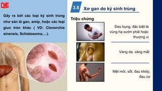 Gây ra bởi các loại ký sinh trùng
như sán lá gan, amip, hoặc các loại
giun tròn khác ( VD: Clonorchis
sinensis, Schistosoma,…).
Đau bụng, đặc biệt là
vùng hạ sườn phải hoặc
thượng vị
Triệu chứng
Xơ gan do ký sinh trùng
3.8
Vàng da, vàng mắt
Mệt mỏi, sốt, đau khớp,
đau cơ
 