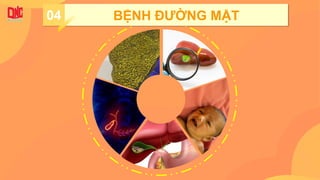 04 BỆNH ĐƯỜNG MẬT
 