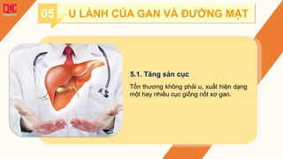 5.1. Tăng sản cục
Tổn thương không phải u, xuất hiện dạng
một hay nhiều cục giống nốt xơ gan.
05 U LÀNH CỦA GAN VÀ ĐƯỜNG MẬT
 