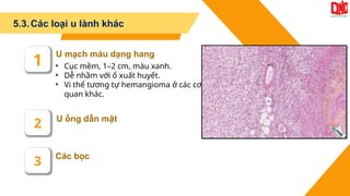 5.3.Các loại u lành khác
Các bọc
U ống dẫn mật
U mạch máu dạng hang
1
2
3
• Cục mềm, 1–2 cm, màu xanh.
• Dễ nhầm với ổ xuất huyết.
• Vi thể tương tự hemangioma ở các cơ
quan khác.
 