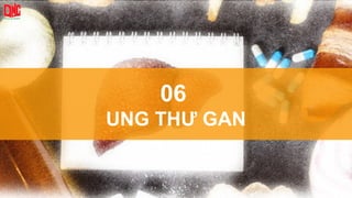 06
UNG THƯ GAN
 