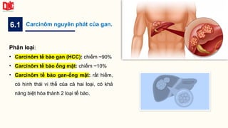 6.1 Carcinôm nguyên phát của gan.
Phân loại:
• Carcinôm tế bào gan (HCC): chiếm ~90%
• Carcinôm tế bào ống mật: chiếm ~10%
• Carcinôm tế bào gan-ống mật: rất hiếm,
có hình thái vi thể của cả hai loại, có khả
năng biệt hóa thành 2 loại tế bào.
 