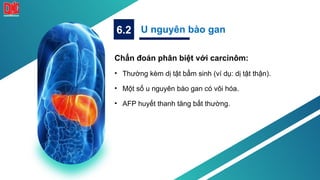 Chẩn đoán phân biệt với carcinôm:
• Thường kèm dị tật bẩm sinh (ví dụ: dị tật thận).
• Một số u nguyên bào gan có vôi hóa.
• AFP huyết thanh tăng bất thường.
U nguyên bào gan
6.2
 