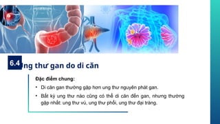 Đặc điểm chung:
• Di căn gan thường gặp hơn ung thư nguyên phát gan.
• Bất kỳ ung thư nào cũng có thể di căn đến gan, nhưng thường
gặp nhất: ung thư vú, ung thư phổi, ung thư đại tràng.
Ung thư gan do di căn
6.4
 
