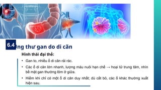 Hình thái đại thể:
• Gan to, nhiều ổ di căn rải rác.
• Các ổ di căn lớn nhanh, lượng máu nuôi hạn chế → hoại tử trung tâm, nhìn
bề mặt gan thường lõm ở giữa.
• Hiếm khi chỉ có một ổ di căn duy nhất; dù cắt bỏ, các ổ khác thường xuất
hiện sau.
Ung thư gan do di căn
6.4
 
