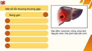 Một số tổn thương thường gặp:
Nang gan
Đặc điểm: nang tròn, mỏng, chứa dịch
Nguyên nhân: mắc phải hoặc bẩm sinh
 