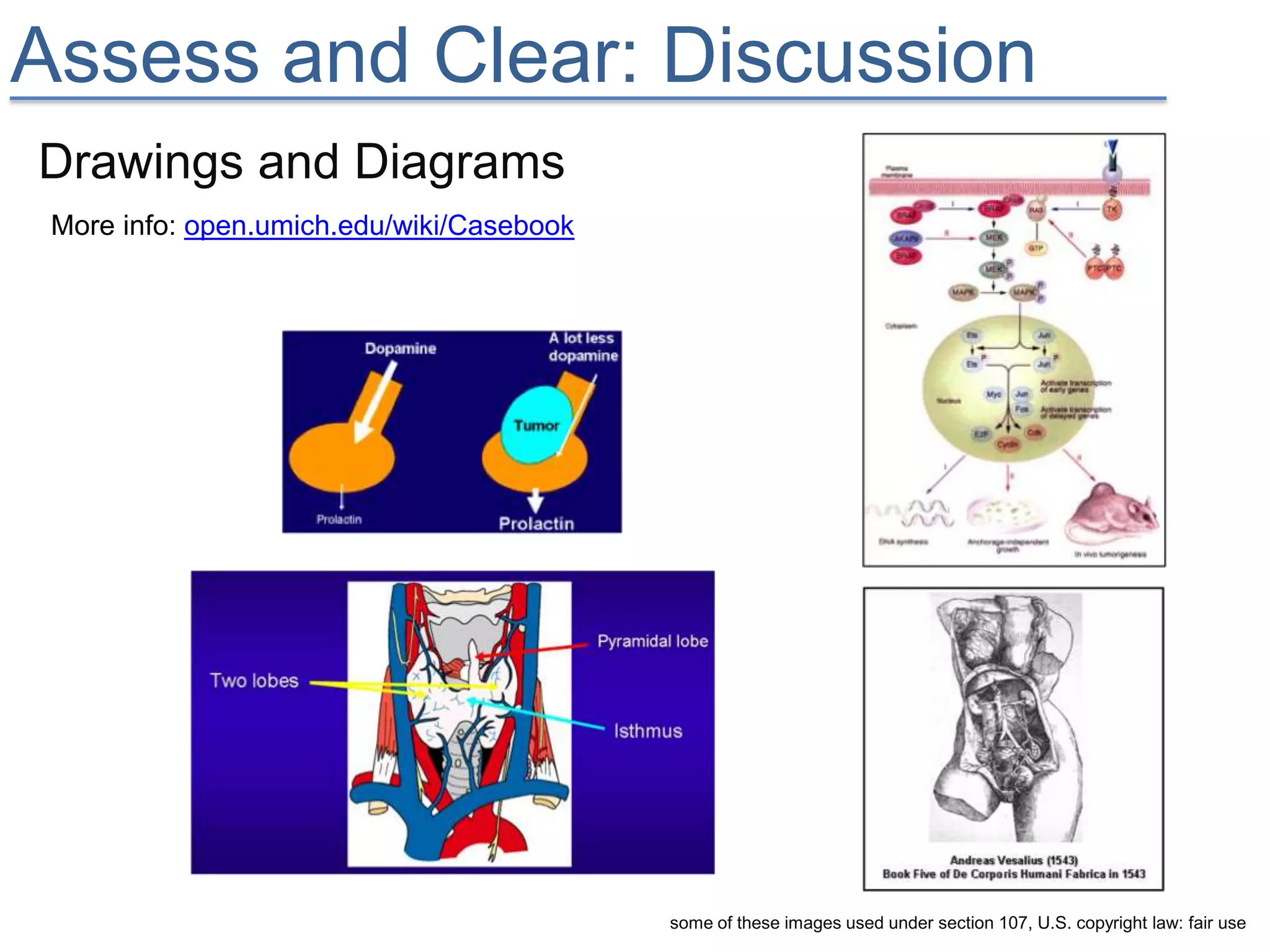 Assess and Clear: Discussion
Drawings and Diagrams
 More info: open.umich.edu/wiki/Casebook




                                           some of these images used under section 107, U.S. copyright law: fair use
 