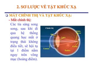 2. SƠ LƢỢC VỀ TẬT KHÚC XẠ
 MẮT CHÍNH THỊ VÀ TẬT KHÚC XẠ:
- Mắt chính thị:
Các tia sáng song
song, sau khi đi
qua hệ thống
quang học mắt ở
trạng thái không
điều tiết, sẽ hội tụ
tại 1 điểm nằm
ngay trên võng
mạc (hoàng điểm).
 