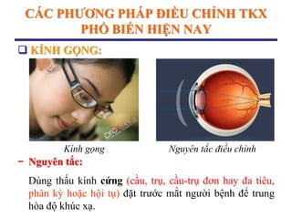 CÁC PHƢƠNG PHÁP ĐIỀU CHỈNH TKX
PHỔ BIẾN HIỆN NAY
− Nguyên tắc:
Dùng thấu kính cứng (cầu, trụ, cầu-trụ đơn hay đa tiêu,
phân kỳ hoặc hội tụ) đặt trước mắt người bệnh để trung
hòa độ khúc xạ.
 KÍNH GỌNG:
Kính gọng Nguyên tắc điều chỉnh
 