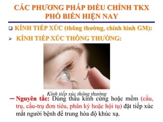 CÁC PHƢƠNG PHÁP ĐIỀU CHỈNH TKX
PHỔ BIẾN HIỆN NAY
─ Nguyên tắc: Dùng thấu kính cứng hoặc mềm (cầu,
trụ, cầu-trụ đơn tiêu, phân kỳ hoặc hội tụ) đặt tiếp xúc
mắt người bệnh để trung hòa độ khúc xạ.
 KÍNH TIẾP XÚC (thông thƣờng, chỉnh hình GM):
 KÍNH TIẾP XÚC THÔNG THƢỜNG:
Kính tiếp xúc thông thường
 